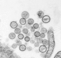 200px-Hantavirus-892334420.gif